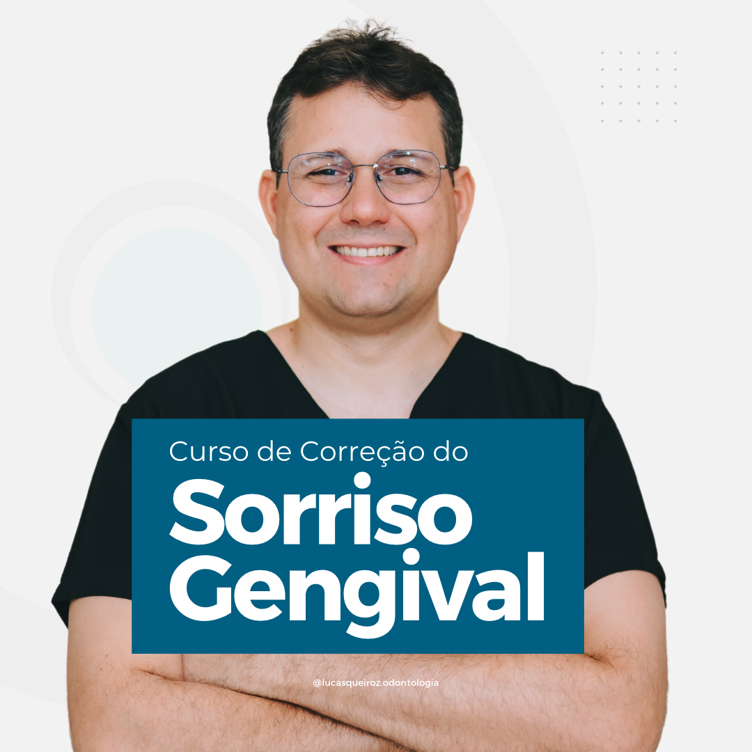 Curso de Correção Gengival