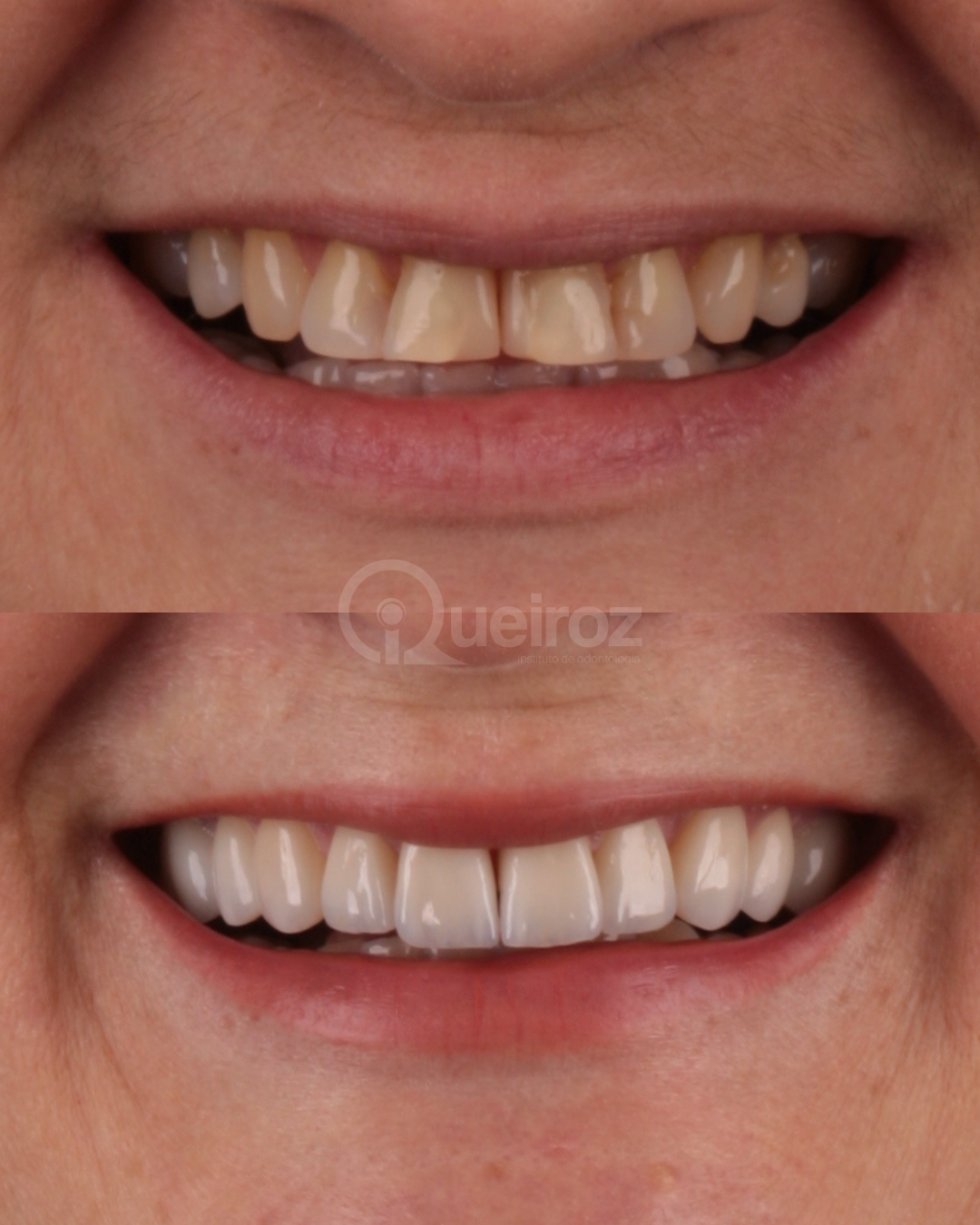 Reabilitação Estética